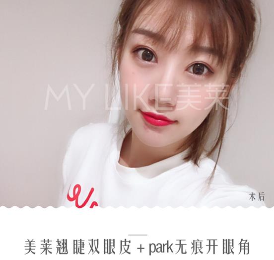 鄭州美萊醫(yī)療美容醫(yī)院正規(guī)嗎 正規(guī)靠譜 為你定制自然美眼