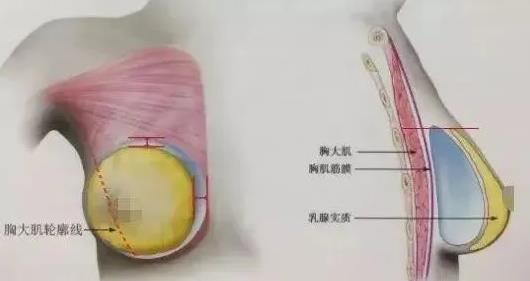 【濟(jì)南整形醫(yī)院排名】如何保證隆胸術(shù)后的手感呢?