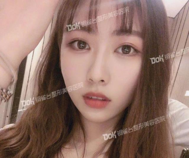 昆明銅雀臺(tái)整形醫(yī)院案例招募火熱進(jìn)行中 美眼/美鼻/美胸三大經(jīng)典項(xiàng)目