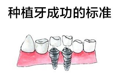 天津全口種植牙疼嗎貼吧_標(biāo)準(zhǔn)種植_選中諾口腔