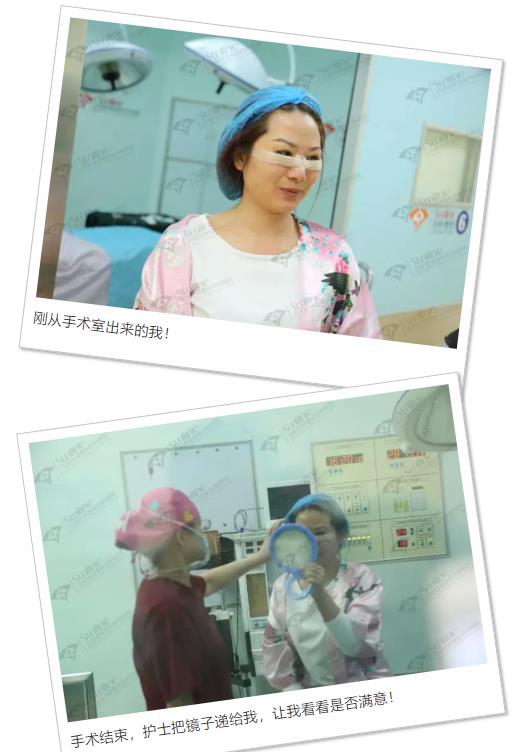 眼袋是怎么形成的,沈陽杏林整形做眼袋多少錢
