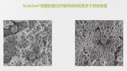 瑞士ITI種植體為口腔健康保駕護(hù)航