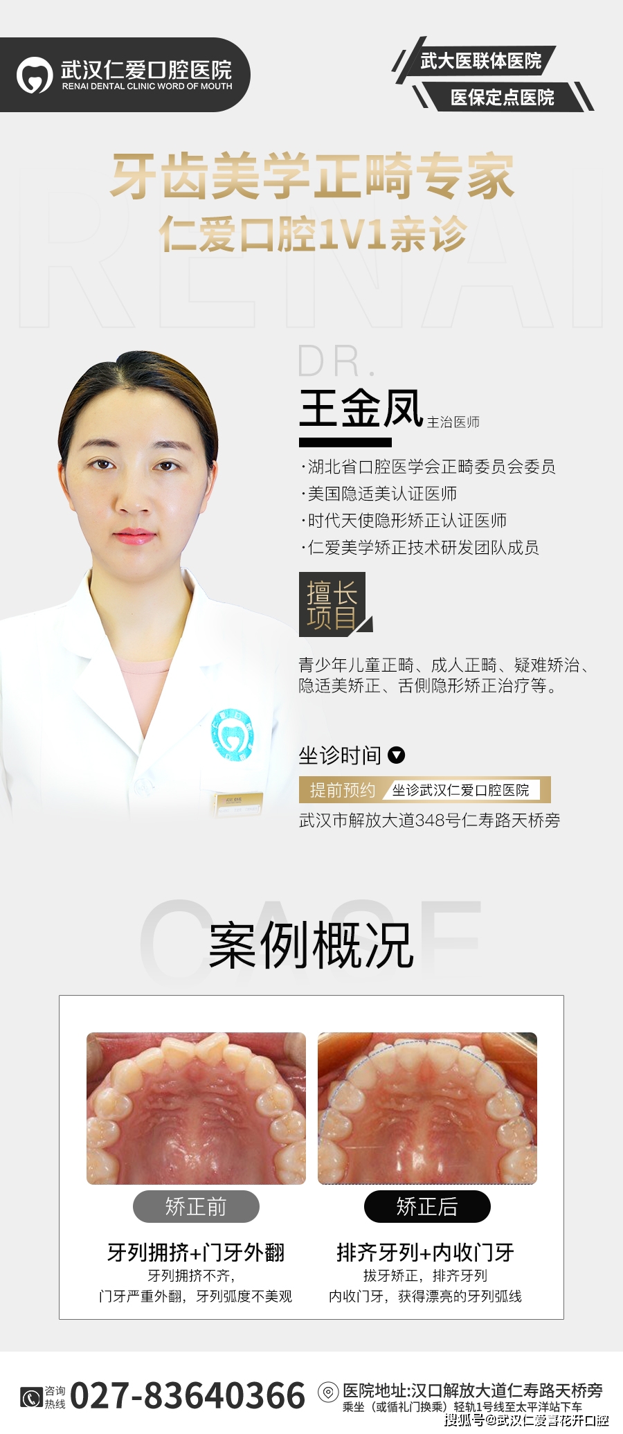 武漢仁愛口腔:同樣是矯正,隱形牙套讓你矯正無煩惱!