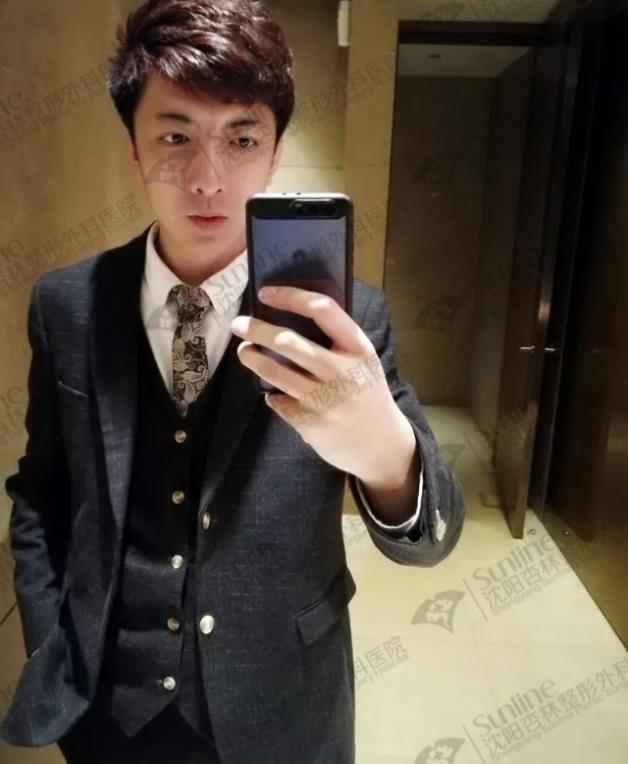 沈陽杏林整形外科醫(yī)院上下頜凸嘴矯正價格表,沈陽哪能削骨