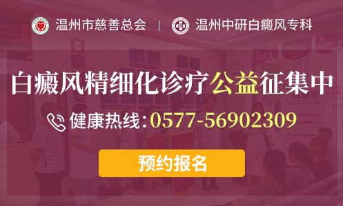 臺州白癜風(fēng)醫(yī)院好不好?白斑容易發(fā)生在哪些部位