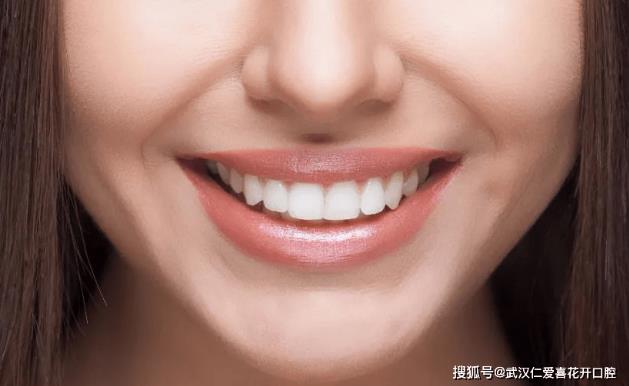多年飽受牙黃牙丑苦惱,通過(guò)牙齒貼面——完美“蛻變”!