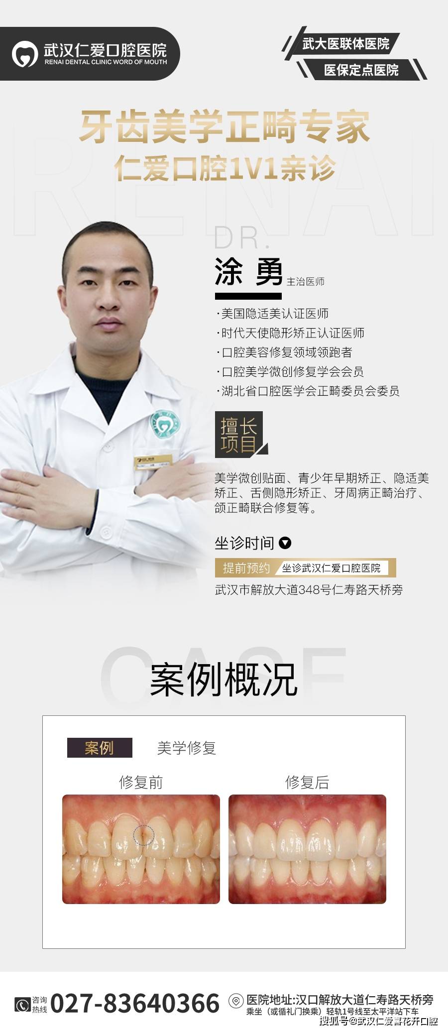 多年飽受牙黃牙丑苦惱,通過(guò)牙齒貼面——完美“蛻變”!