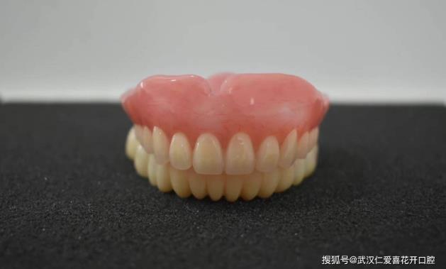 武漢口腔醫(yī)院修復案例像種植牙一樣“穩(wěn)固”的活動假牙