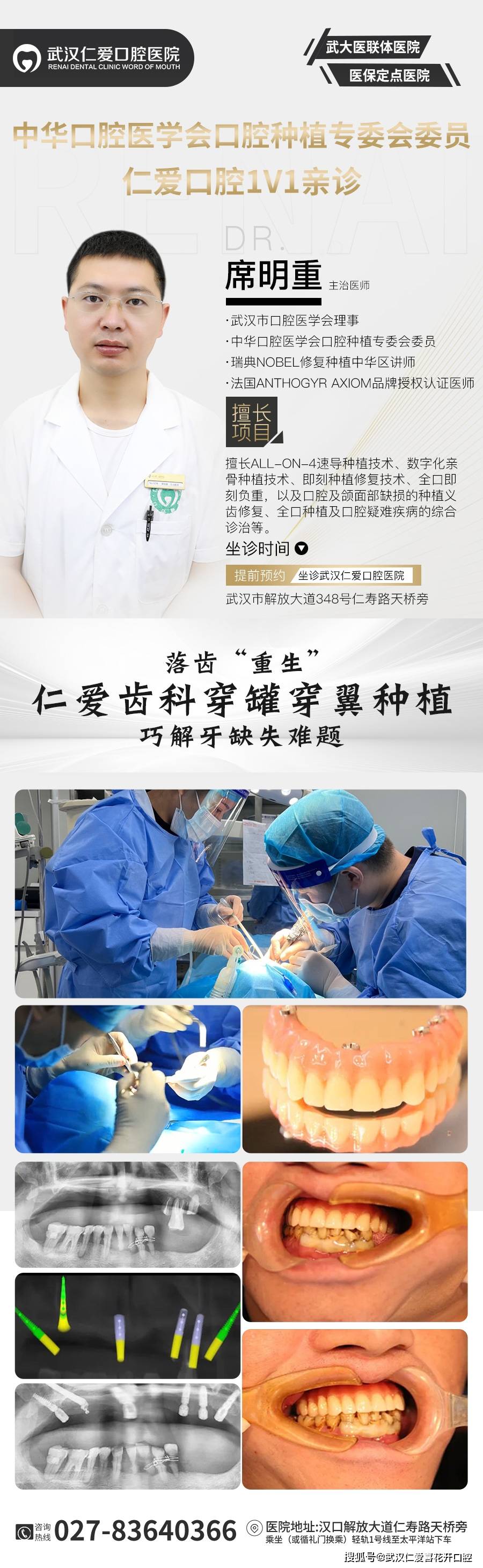 武漢口腔醫(yī)院修復案例像種植牙一樣“穩(wěn)固”的活動假牙