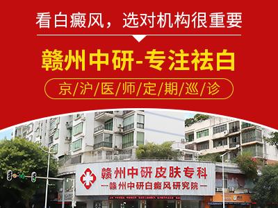 贛州中研白癜風(fēng)醫(yī)院趙玉華醫(yī)生上班時間 白癜風(fēng)具體檢查有哪些? 400-300-5.jpg