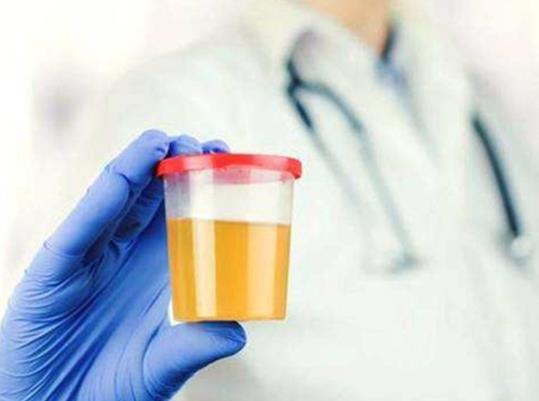 尿酸550不吃藥能降回正常值嗎?年輕人尿酸長期500左右嚴重嗎