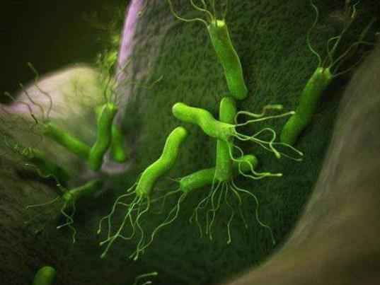 感染幽門螺桿菌有什么癥狀?幽門螺旋桿菌陰性正常嗎