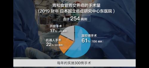 全球腫瘤醫(yī)生網(wǎng)帶您走進日本國之名醫(yī)木下敬弘:以“零并發(fā)癥”為目標的全新胃癌手術