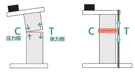 聯(lián)合麗格第一醫(yī)院何照華教授:顴骨內(nèi)推后面部皮膚一定會(huì)下垂嗎? 69b954b3ly1gqx0iphr2ej20c606p75g.jpg