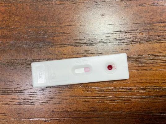 hiv試紙檢測準(zhǔn)確嗎?hiv試紙血量少會怎樣