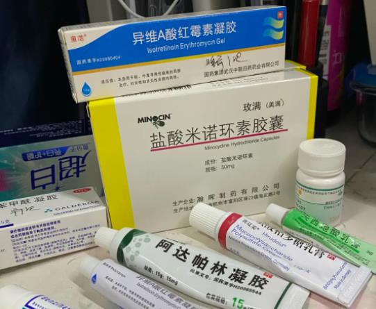 米諾環(huán)素停了就爆痘是什么原因?米諾環(huán)素吃一周會傷腎嗎