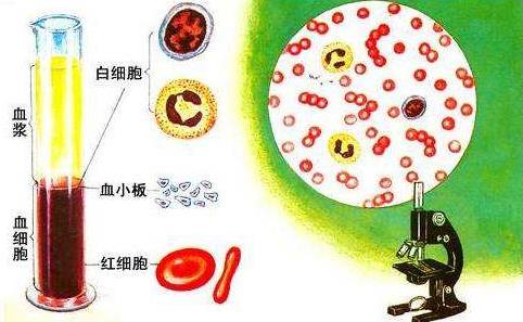 北京國康醫(yī)院能治血小板減少性紫癜嗎 海文琪中醫(yī)并舉告別激素藥