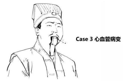 漫畫科普-糖尿病治療新模式