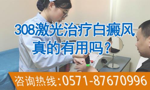 華研白癜風(fēng)醫(yī)院的308激光治療效果怎么樣?前端技術(shù),值得相信
