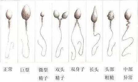 芬愛兒孕育:了解精子形態(tài)的小秘密,助您成功受孕!