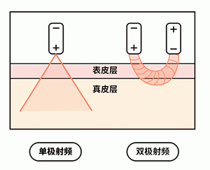 【武漢藝星整形醫(yī)院】一篇文章讓你讀懂抗衰神器“熱瑪吉”! 9.gif