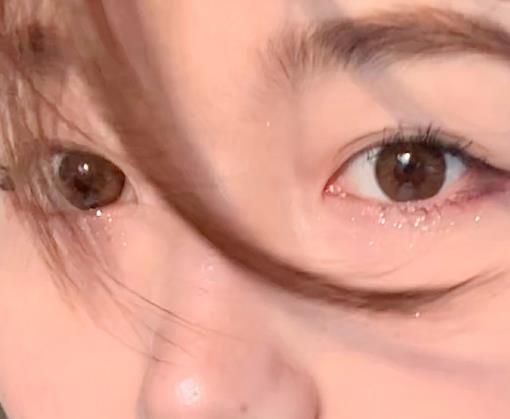 美瞳模糊是怎么回事?近視戴0度美瞳會(huì)模糊嗎?