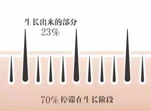 不嫁接、不種植,印度凱普絲careprost睫毛增長液,愛美女性必備!