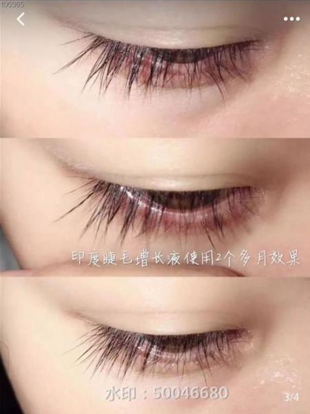 不嫁接、不種植,印度凱普絲careprost睫毛增長液,愛美女性必備!
