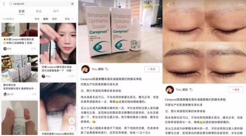 不嫁接、不種植,印度凱普絲careprost睫毛增長液,愛美女性必備!