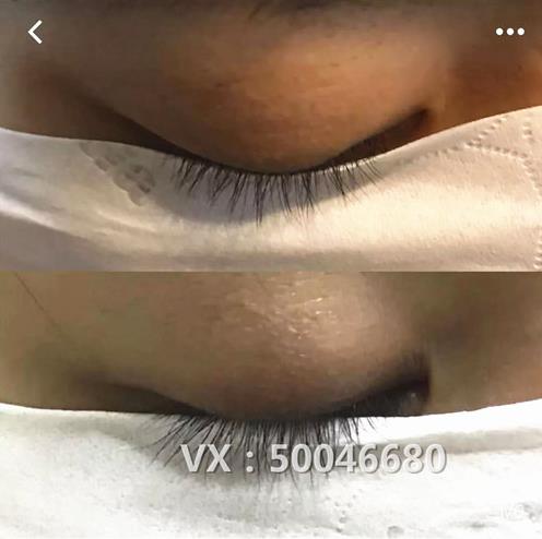 不嫁接、不種植,印度凱普絲careprost睫毛增長液,愛美女性必備!