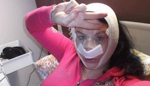 世界上整容最多的女人 美國女子整容36次揚言還會繼續(xù)整下去