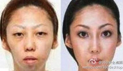 【老婆太丑】老婆漂亮女兒太丑,男子告整容老婆獲賠75萬(wàn),是整容醫(yī)院炒作嗎