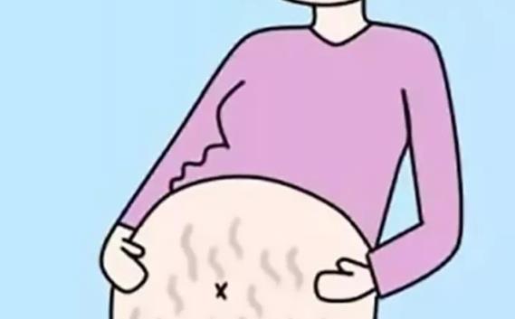 女性對(duì)于消除妊娠紋存在一定的誤解 消除妊娠紋常遇到的四大誤區(qū)