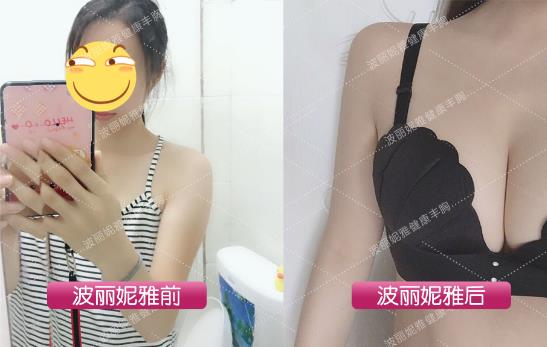 斷奶后胸變小怎么辦?辣媽必知的產(chǎn)后高效豐胸法!