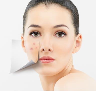 臉上長痘痘是什么原因?臉上長痘痘怎么調(diào)理?青春痘怎么消除