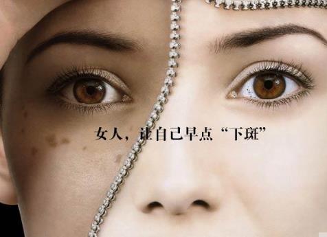 經(jīng)期延長引發(fā)黃褐斑怎么辦?如何預(yù)防黃褐斑