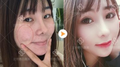 惠合嘉美整形好嗎 專業(yè)服務(wù) 塑造你的專屬美