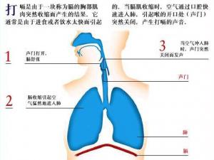 打嗝不止怎么辦？打嗝偏方