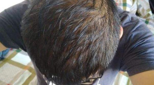 男人如果腎虛的話就會導(dǎo)致性能力下降 男人腎虛的6大癥狀
