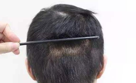 誰(shuí)都不想提前衰老 男人提前衰老預(yù)防的方法介紹給你