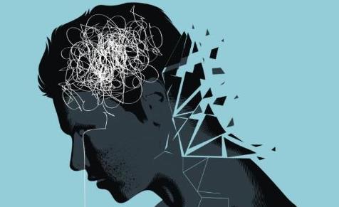 男性脫發(fā)的原因有哪些 職場壓力該怎么緩解
