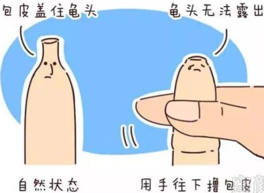男人為什么要割包皮?割包皮前要注意事項 割包皮后注意事項