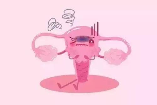 盆腔淤血是怎么引起?盆腔淤血的癥狀是什么