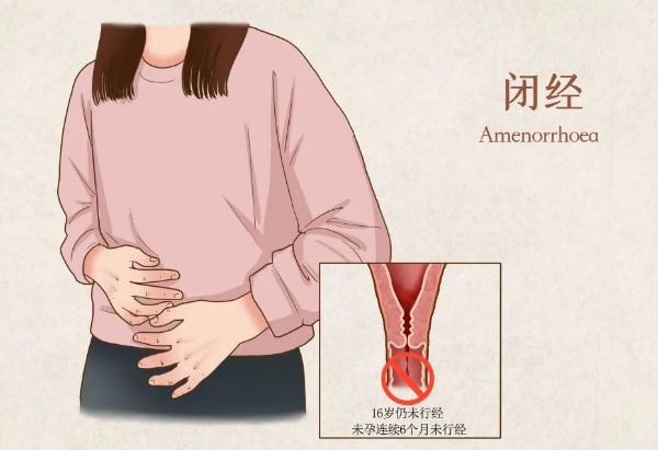 閉經(jīng)是怎么回事?造成閉經(jīng)的原因有哪些?