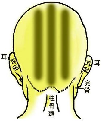骨相圖解:川字骨