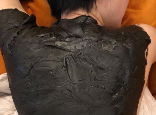 泥灸對婦科炎癥有用嗎?泥灸能把體內(nèi)寒濕全部排出來嗎?