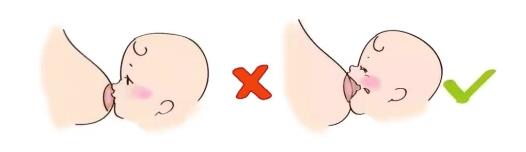 康哺樂®母乳益生菌預(yù)防、緩解哺乳期乳腺炎,全程守護(hù)母嬰健康!