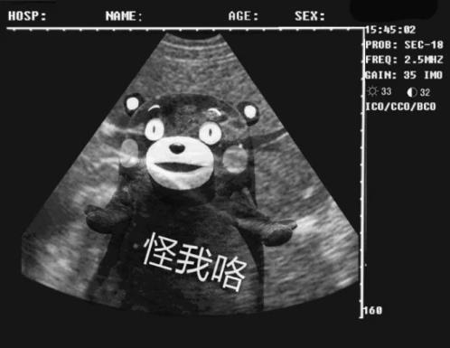 孕婦奶粉哪個(gè)品牌好 選對(duì)這個(gè)沒煩惱