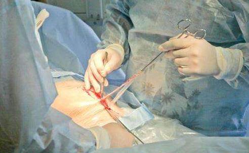 你想做剖腹產(chǎn)嗎 剖腹產(chǎn)的好處與弊端