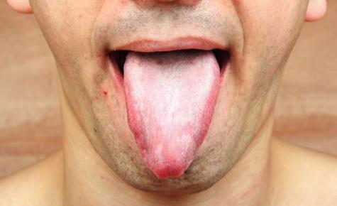 孕婦嘴巴發(fā)苦的話是正常的嗎 孕婦嘴巴發(fā)苦怎么改善